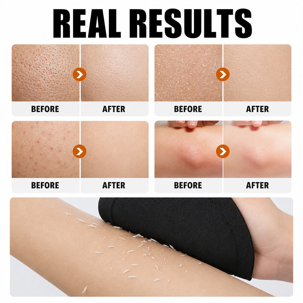 🧽 4-Pack Soft Rubber Shower Scrubber – Gentle Yet Effective, Exfoliates & Cleanses All Skin Types