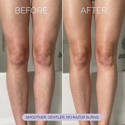 thesbox Hair Removal Mousse