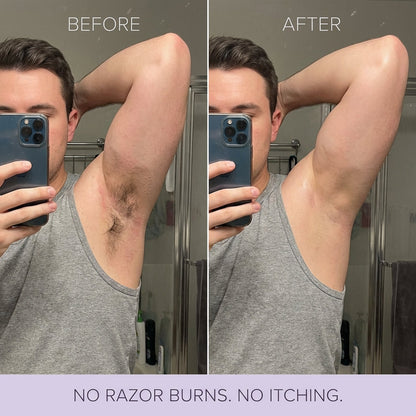 thesbox Hair Removal Mousse
